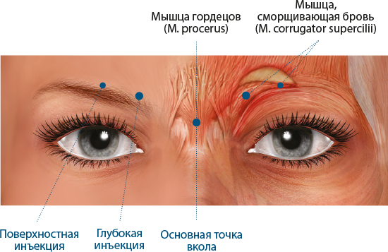 Иллюстрация действия